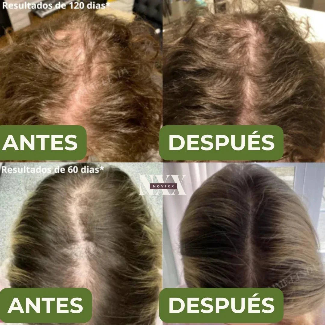 Champú Natural de Batana y Extracto de Romero